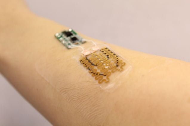 A real-time ultraflexible sensor that makes inflammation testing and curing 30 times faster