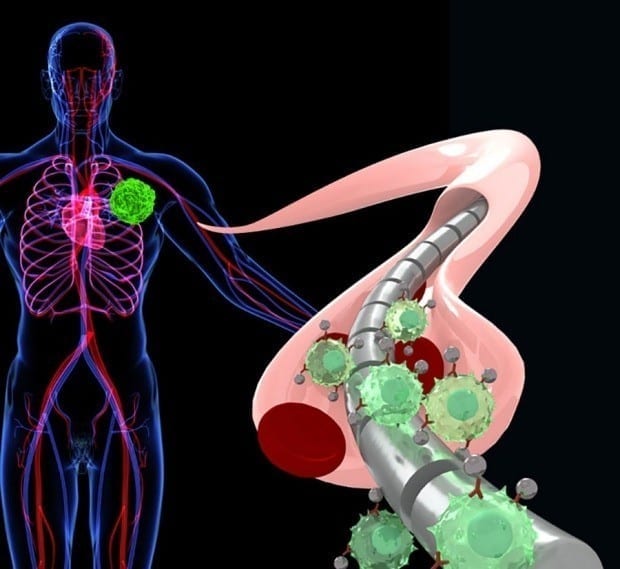 Using a magnetized wire to detect cancer earlier