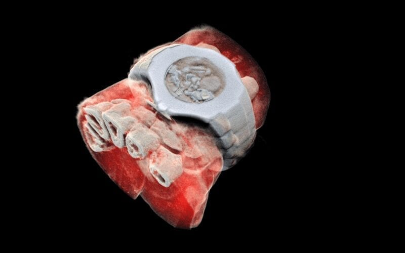 First 3D colour X-ray of a human