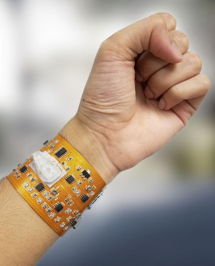 Smart phones linked to a smart wristband could monitor health and environmental exposures
