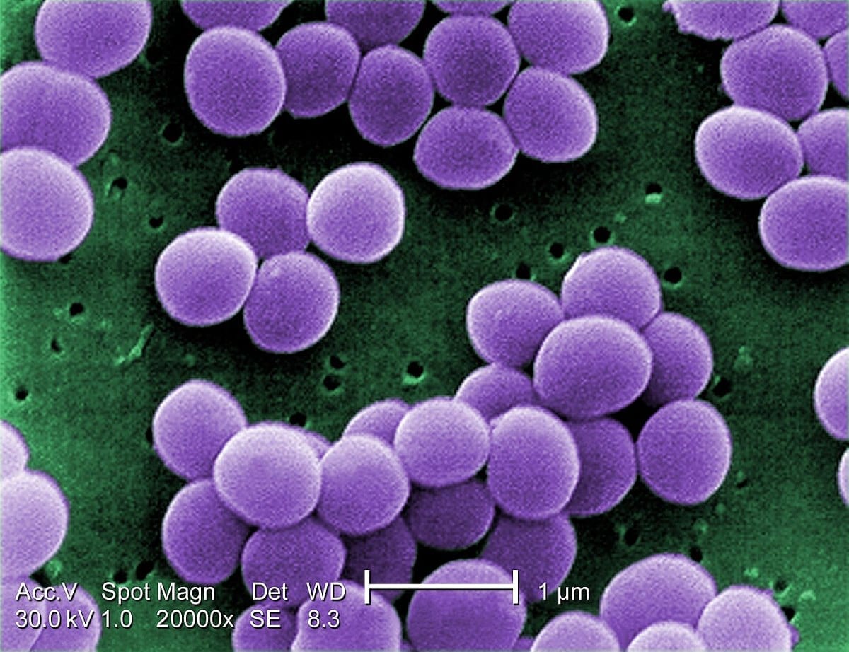 Stopping an antibiotic-resistant superbug with genetic disruption