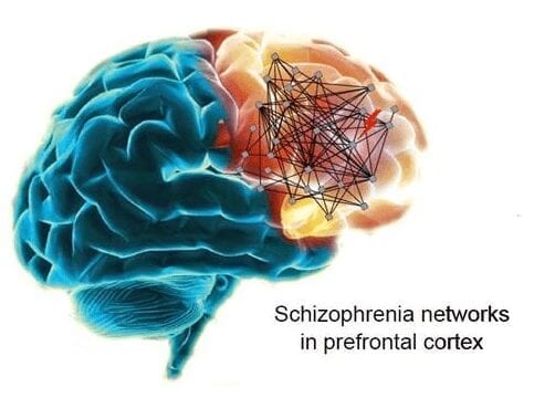 Big breakthrough in schizophrenia research