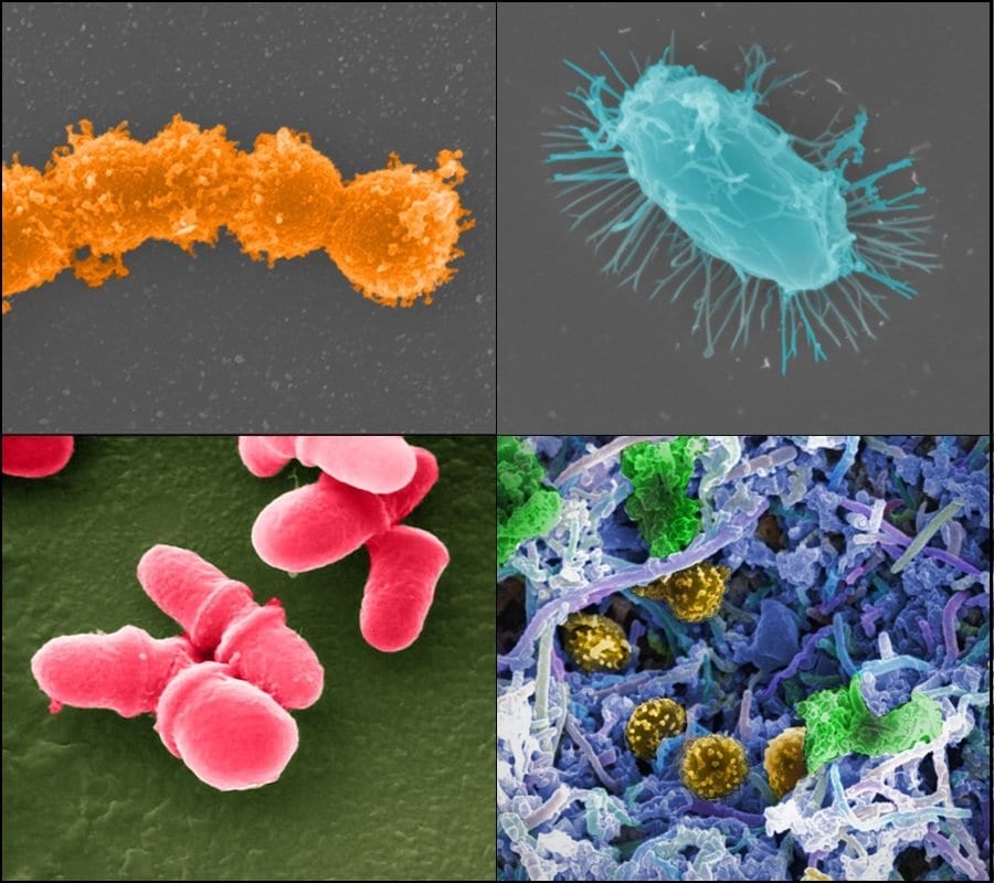 Fecal microbiota transplantation could offset harsh effects of antibiotics in cancer patients