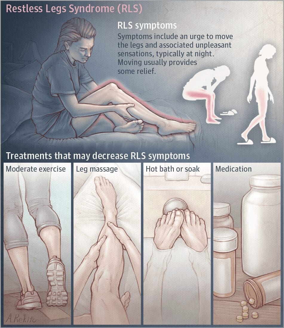 Restless legs syndrome gets a real starting point for potential treatments