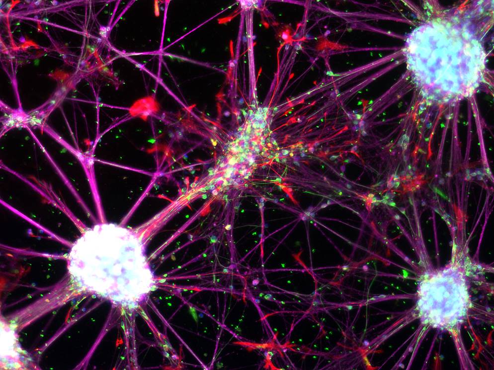Regenerative medicine: Human blood cells can be directly reprogrammed into neural stem cells