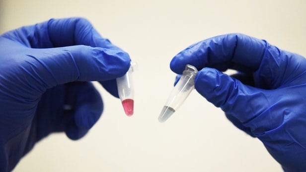 New easy test from blood or biopsy could revolutionise cancer diagnosis
