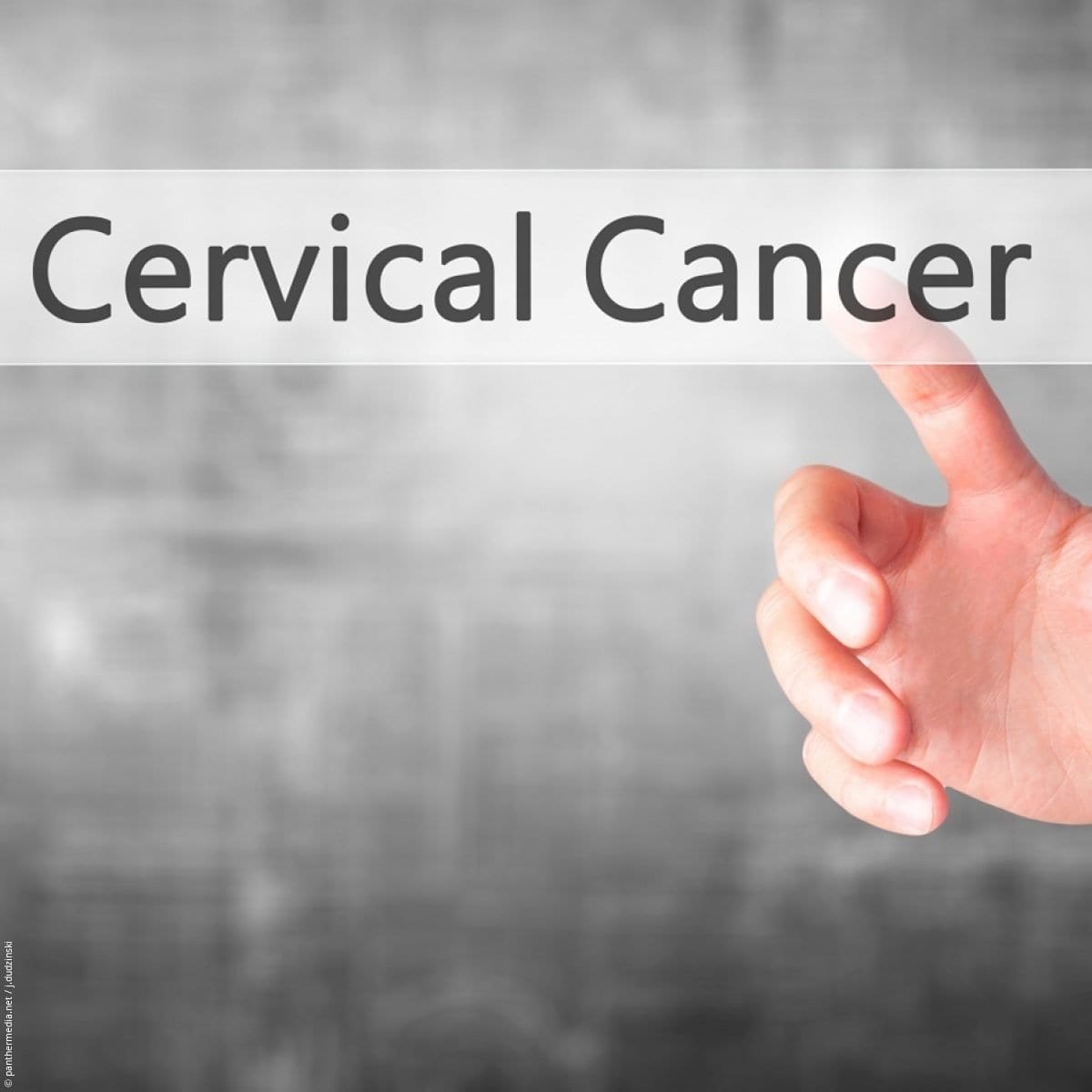 Revolutionizing cervical cancer screening using artificial intelligence