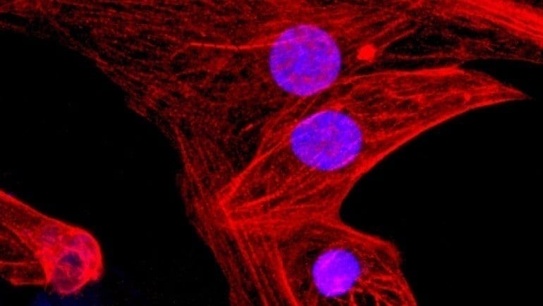 New CRISPR-Cas9 gene editing technique prevents rejection of stem cell transplants