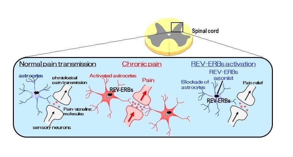 A new target for chronic pain relief