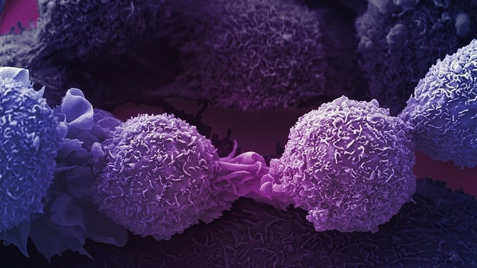 Precision cancer drugs boost the immune system and help more patients benefit from immunotherapy