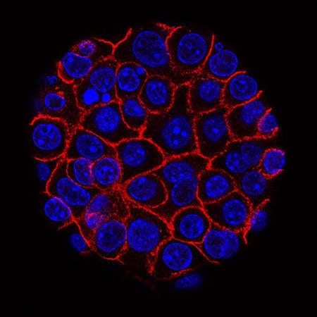 New strategies to target pancreatic cancer