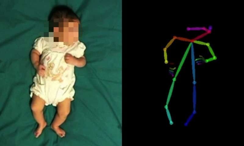 Using artificial intelligence techniques to assess a child’s development and ongoing therapy