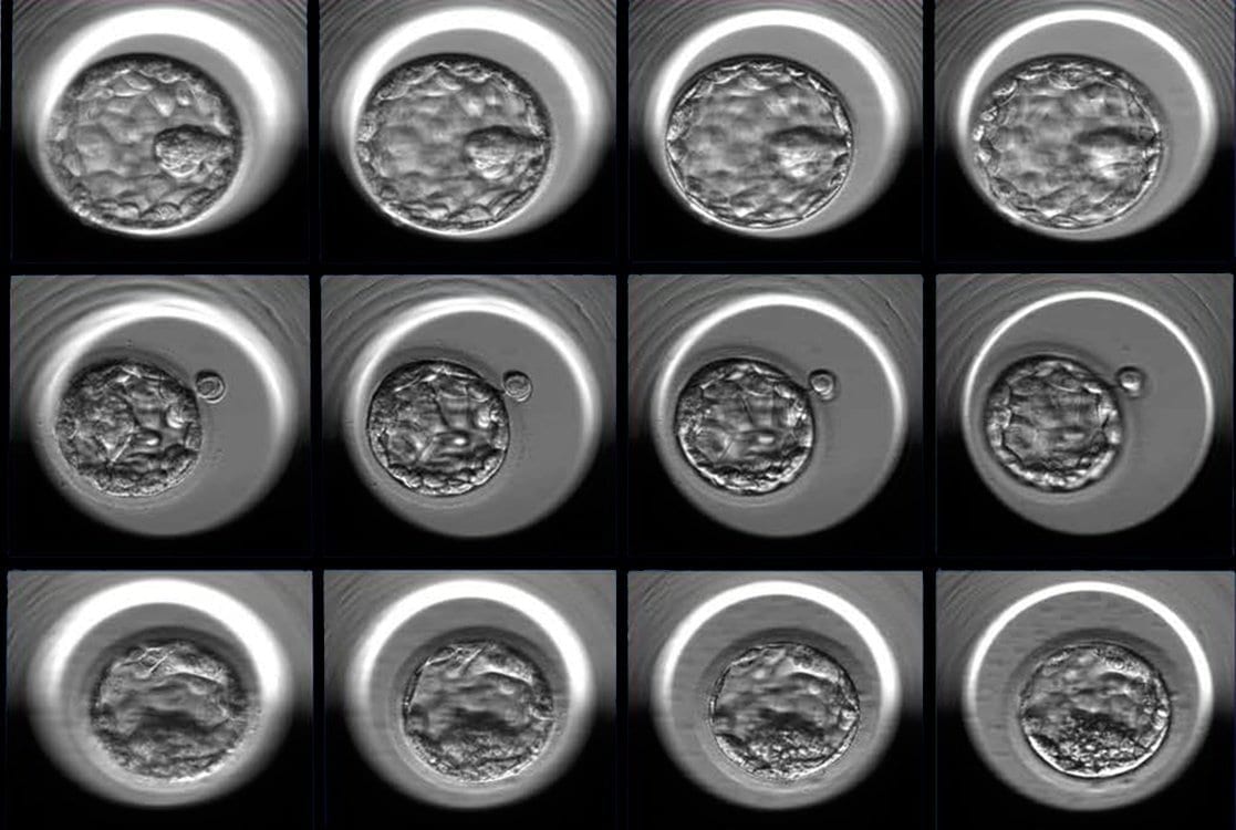 Artificial intelligence weighs in on whether an in vitro fertilized human embryo has a high potential to progress to a successful pregnancy