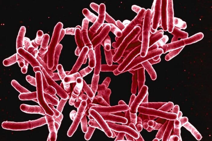 Can drug resistance in tuberculosis be reversed?