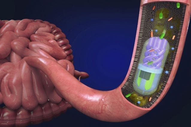 3D printed pill can sample the gut microbiome for diagnosis and treatment