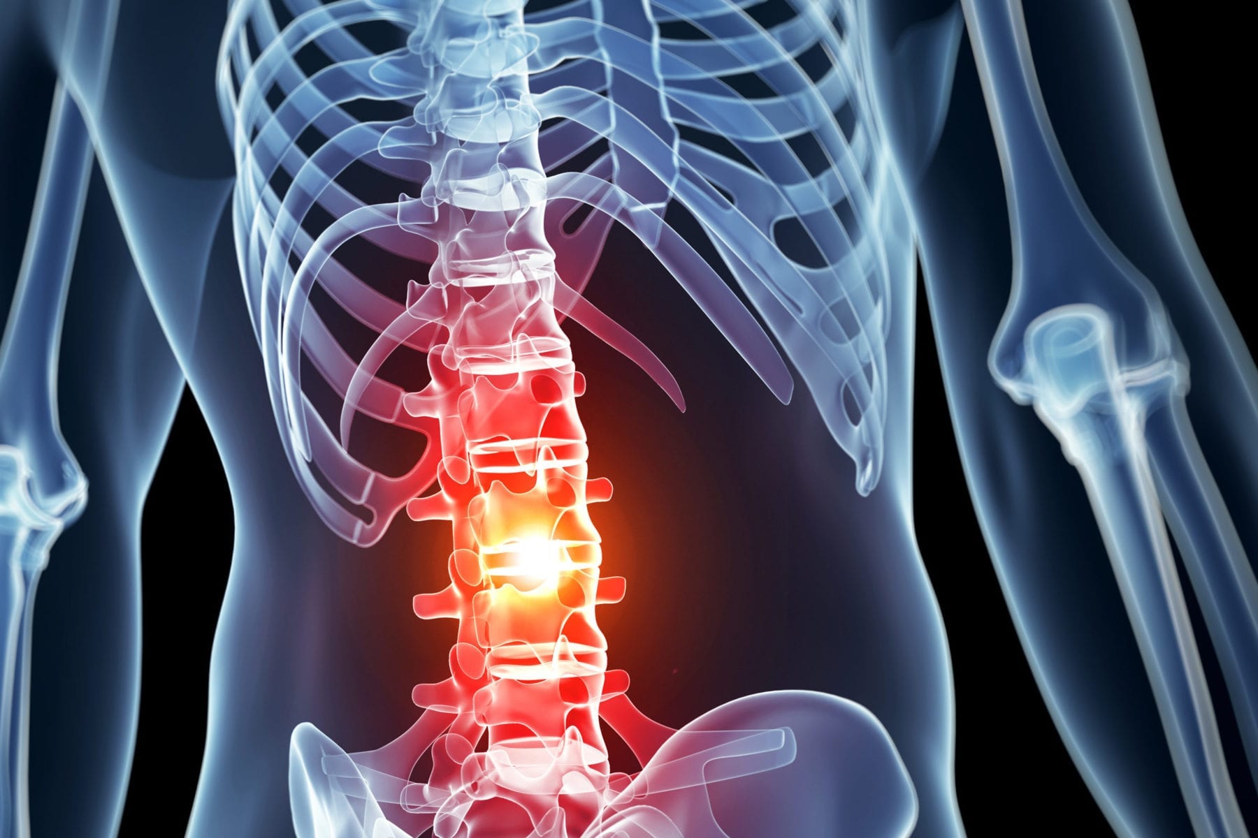 The potential to prevent some spinal cord injuries from resulting in paralysis