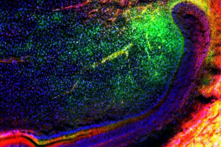 Could teeth be on the edge of self-repair with stem cells?