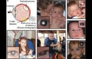 A new smartphone app can help detect early signs of eye disease in children