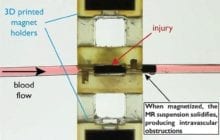 An injectable magnetizable fluid could extend trauma patients' survival time