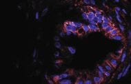 A new approach to treating pancreatic cancer