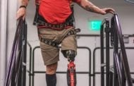 One of the world’s first truly bionic legs