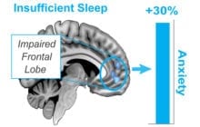 Sleep as a natural non-pharmaceutical remedy for anxiety disorders?