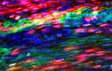 Revolutionizing injury recovery by using tendon stem cells