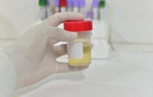 A simple urine test for prostate cancer detection can now use urine samples collected at home
