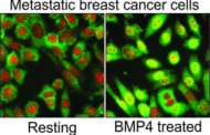 Can activation of a distinct genetic pathway slow the progress of metastatic breast cancer?