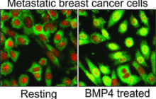 Can activation of a distinct genetic pathway slow the progress of metastatic breast cancer?