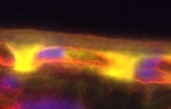 A new protein linked to age-related macular degeneration offers hope for diagnosis and treatment
