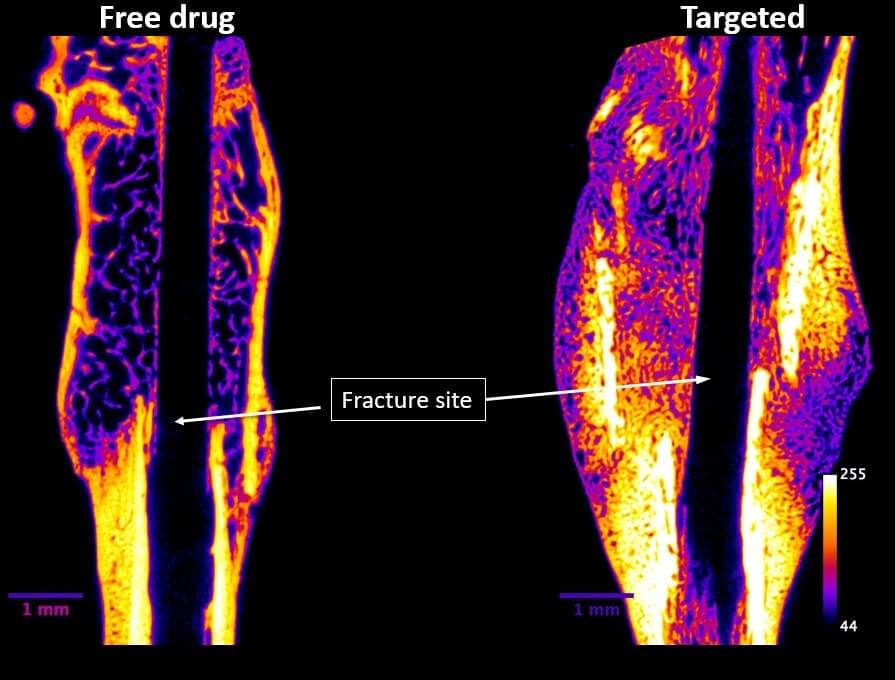 Novosteo, a Purdue-affiliated startup, is advancing a technology shown to repair bone fractures faster and at greater benefit to a patient. The image above shows fractured femurs at four weeks post-fracture. The ‘Targeted’ bone received Novosteo’s injectable targeted drug. Yellow and orange colors indicate higher density bone than purple and blue. (Image provided by Novosteo)