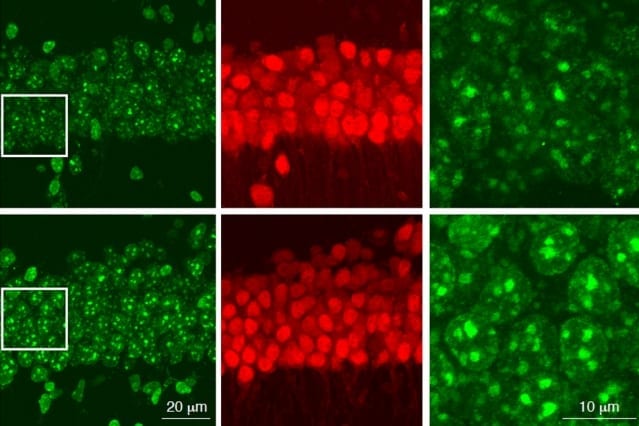 In this figure, neurons in the bottom row, which are missing the HDAC1 gene, show higher levels of DNA damage (green) than normal neurons.

Image courtesy of the researchers
