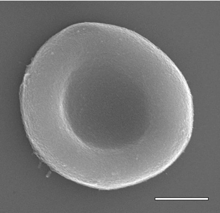 Artificial red blood cells, like the one shown here, could carry oxygen, therapeutic drugs and other cargo in the bloodstream. Scale bar, 2 ?m.
Credit: Adapted from ACS Nano 2020, DOI: 10.1021/acsnano.9b08714
V