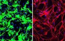 One-time treatment eliminates Parkinson's disease and regrows neurons: in mice