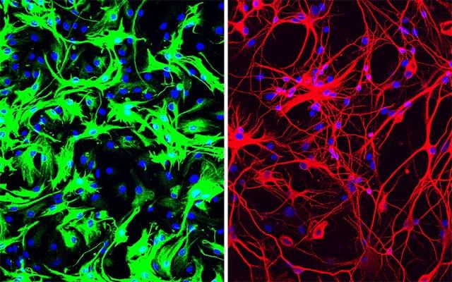 Left: mouse astrocytes (green) before reprogramming; Right: neurons (red) induced from mouse astrocytes after reprogramming with PTB antisense oligonucleotide treatment.

CREDIT
UC San Diego Health Sciences