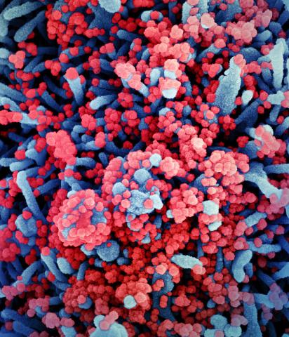 Colorized scanning electron micrograph of a cell (blue) heavily infected with SARS-CoV-2 virus particles (red), isolated from a patient sample. Image captured at the NIAID Integrated Research Facility (IRF) in Fort Detrick, Maryland.

Credit: NIAID
