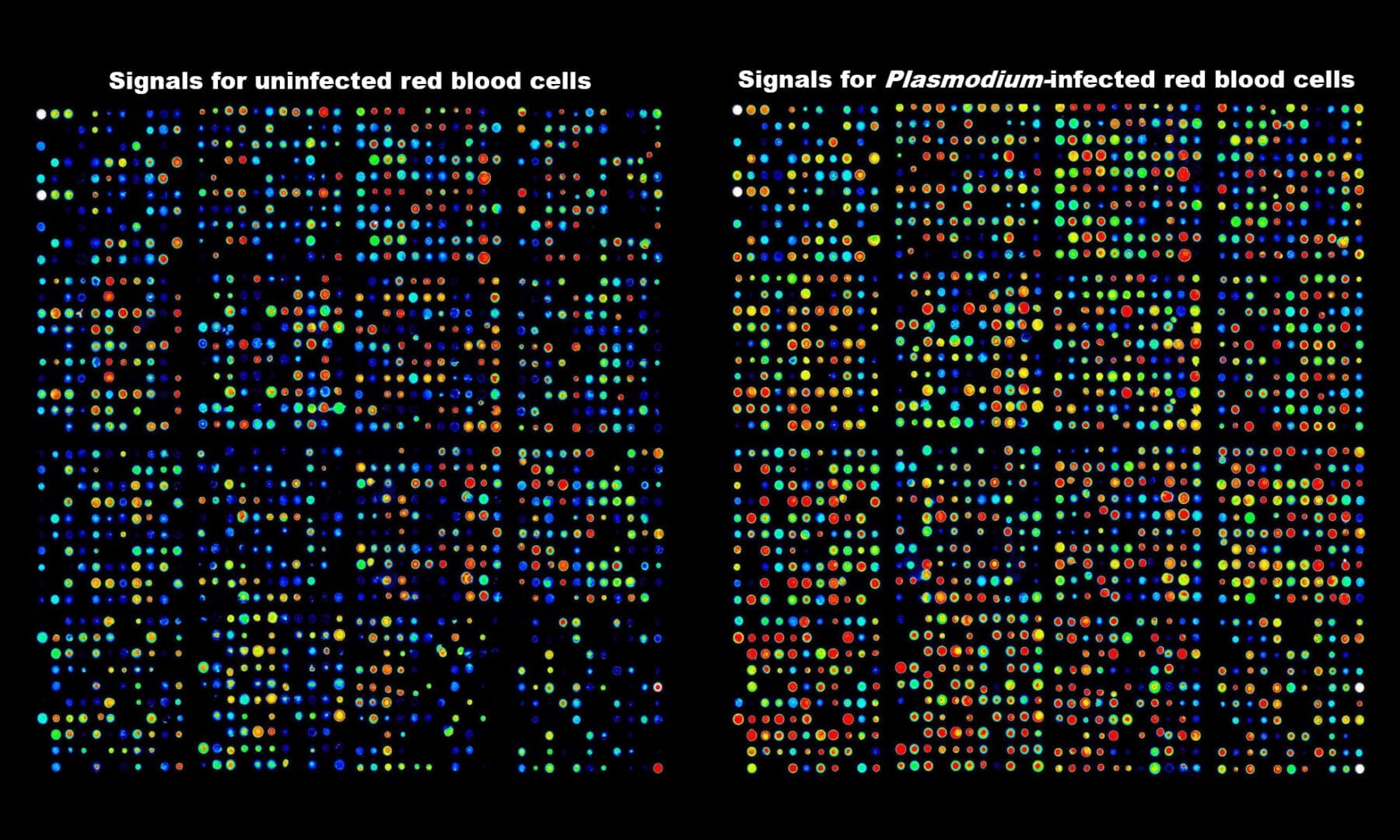 Antibody array data showing activation of kinases in human red blood cells infected with the malaria parasite.