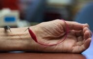 Could electroacupuncture tamp down systemic inflammation in the body?
