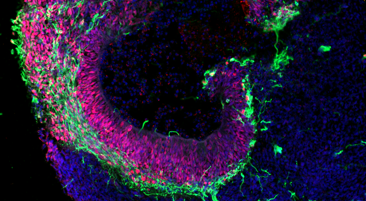 Image showing sections of cerebral brain organoids derived from pluripotent stem cells.

via Agnieszka Rybak-Wolf, MDC/LifeTime