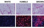 HUMBLE cells, created from human white fat, can treat metabolic diseases such as obesity and type 2 diabetes
