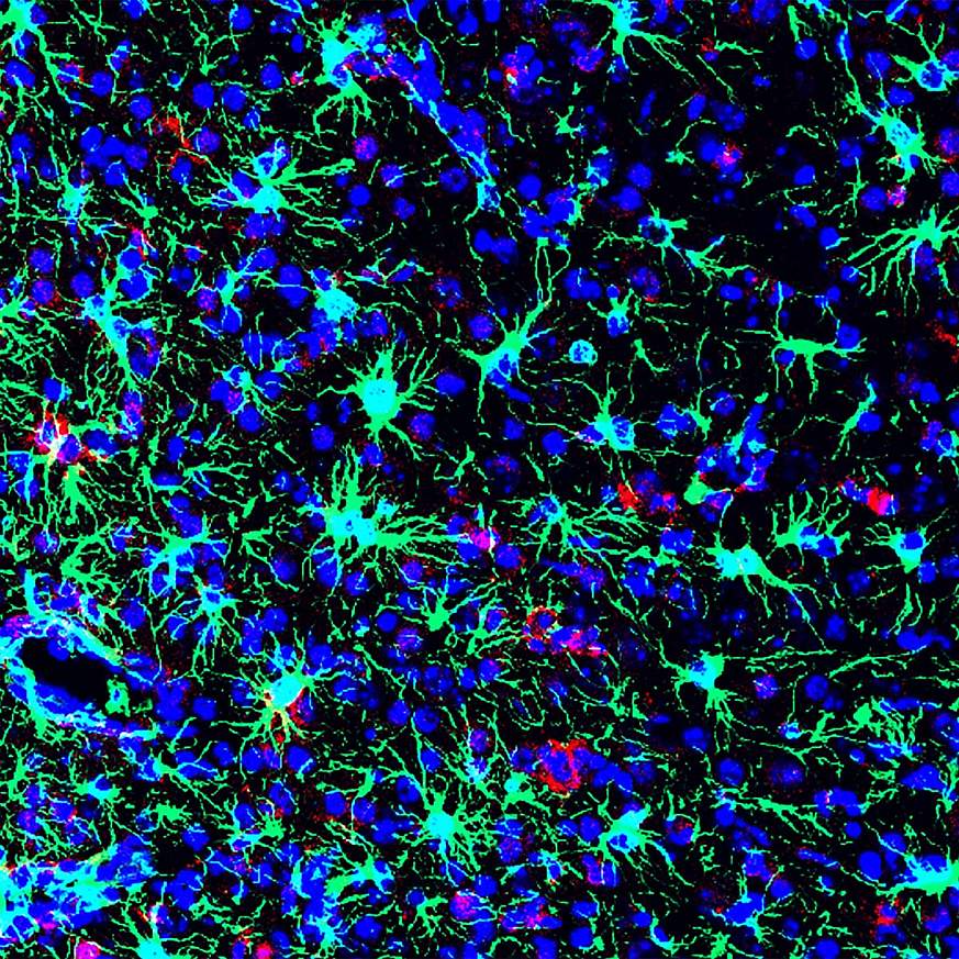 Combating Zika

In a preclinical study, NIH scientists found that the commonly used antibiotic methacycline may be effective at combating the neurological problems caused by Zika virus infections. Here is a picture of a Zika-infected mouse brain from the study. Courtesy of Nath lab NIH/NINDS.