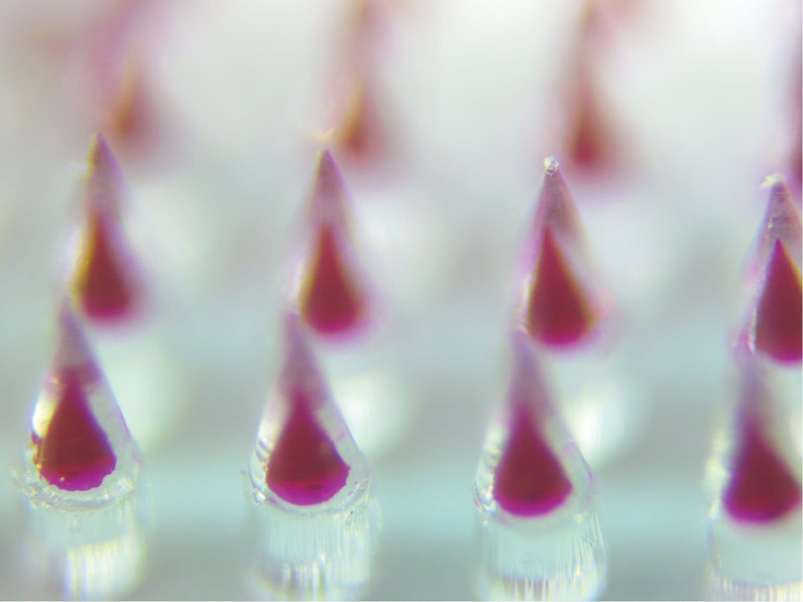 Microneedle technology offers several advantages over traditional vaccines, including ease of application and the reduction of hazardous medical waste (courtesy of Thanh Nguyen).