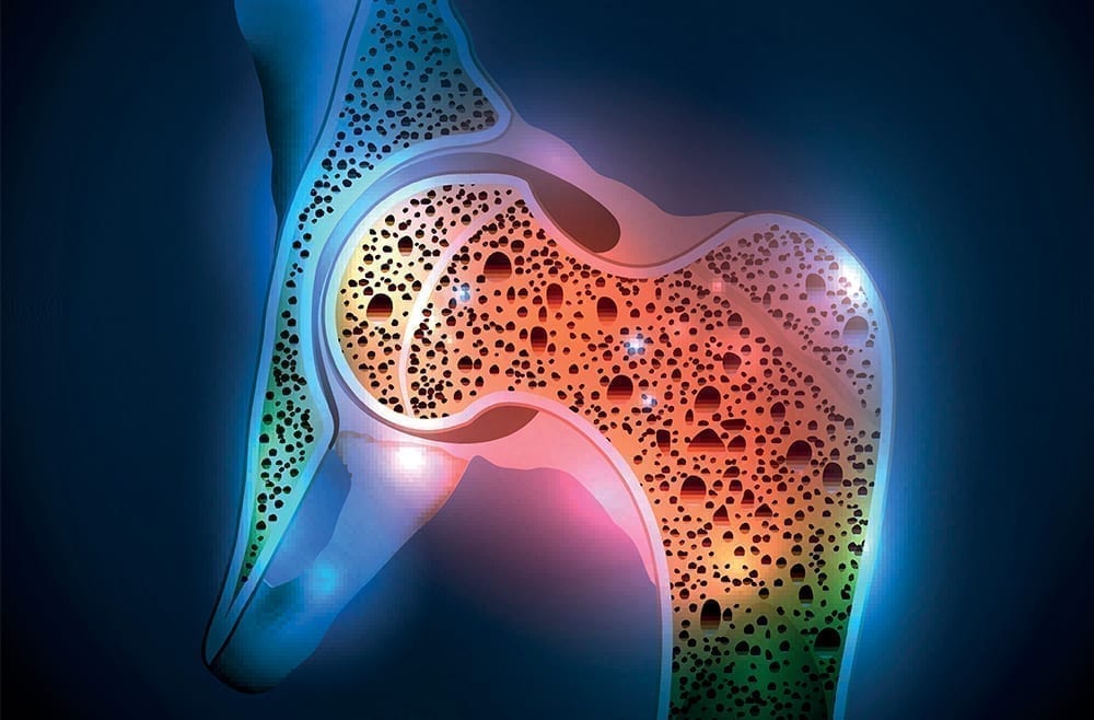 Researchers appear to have halted the osteoporosis process that breaks down bone - in mice