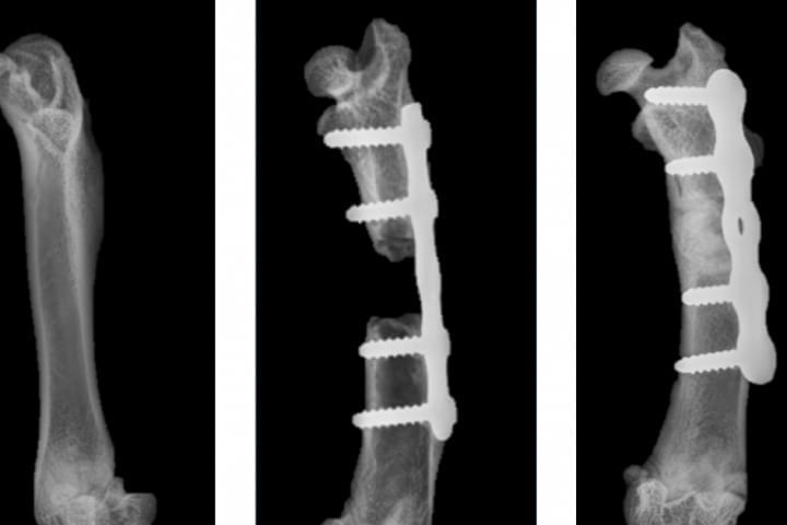 Healing skeletal injuries with synthetic bone