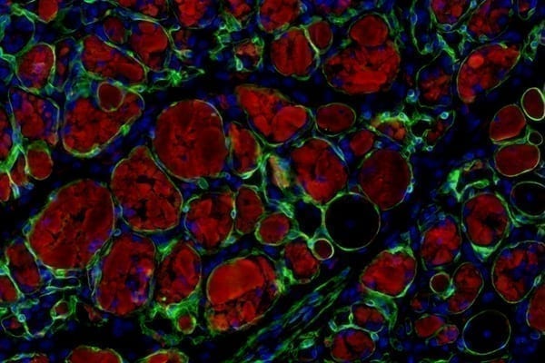 Microscope image showing muscle stem cells produced using the newly discovered chemical cocktail. Muscle cells, in red, are integrating into injured muscle, in green, of an adult mouse.