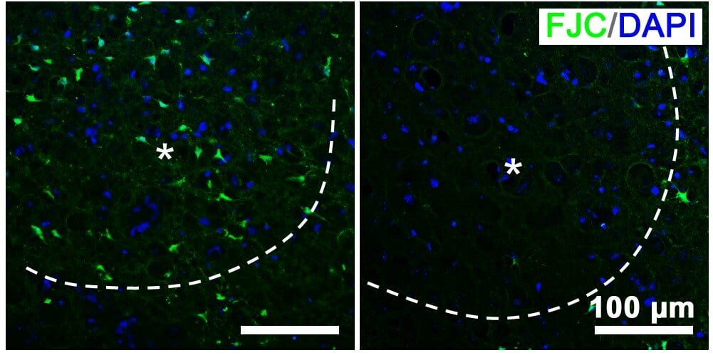 Brain slices of mice that received nano-photosynthetic therapy (right) have fewer damaged neurons, shown in green, than control mice (left).

CREDIT
Adapted from Nano Letters 2021, DOI: 10.10.21/acs.nanolett.1c00719