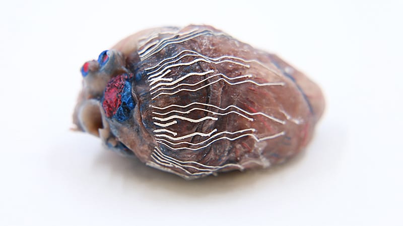 A fully printable biosensor made of soft bio-inks interfaces with a pig heart. Research about the biosensor, developed by researchers at Purdue University and Los Alamos National Laboratory, has been published in Nature Communications. (Photo Credit: Bongjoong Kim)