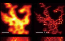 Now ordinary microscopes can see in super resolution with a new light-shrinking material