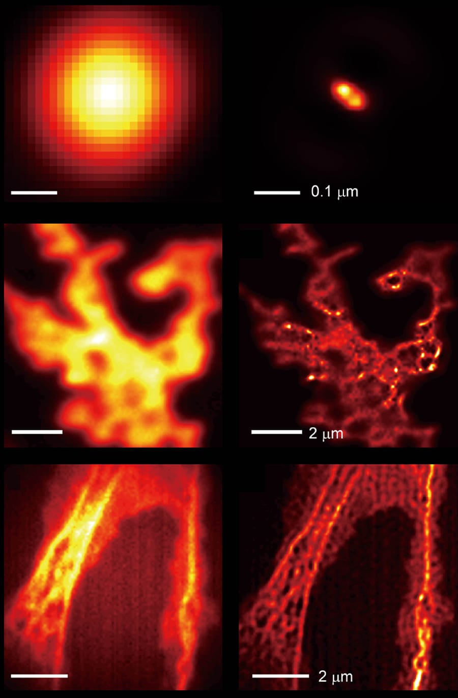 Comparison of images taken by a light microscope without the hyperbolic metamaterial (left column) and with the hyperbolic metamaterial (right column): two close fluorescent beads (top row), quantum dots (middle row), and actin filaments in Cos-7 cells (bottom row). Adapted from Nature Communications